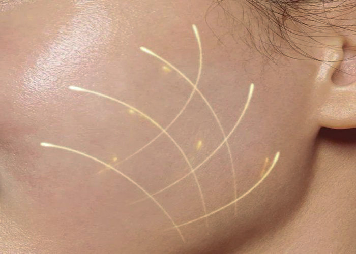 collagen-thủy-phân