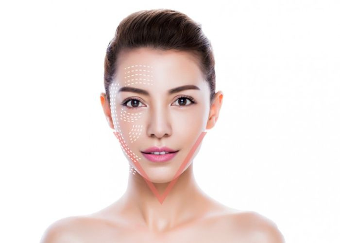 so sánh các phương pháp căng da mặt