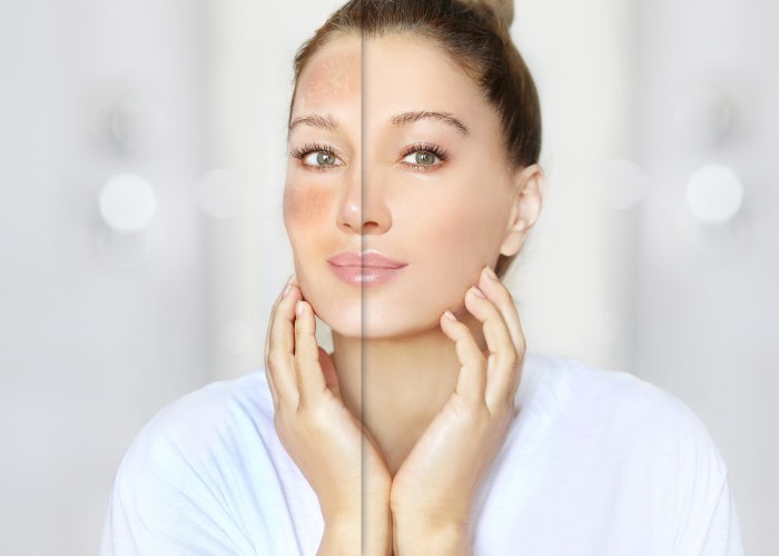 collagen thủy phân từ cá