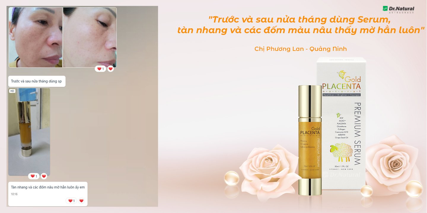 Serum Nhau Thai Cừu Dr Natural Astragrace Gold Placenta 24k giúp dưỡng ẩm, dưỡng da, trắng da, chống lão hoá da