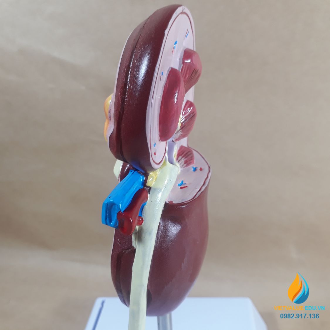 Mô hình quả thận, mô hình bệnh lý thận, mô hình giải phẫu giảng dạy