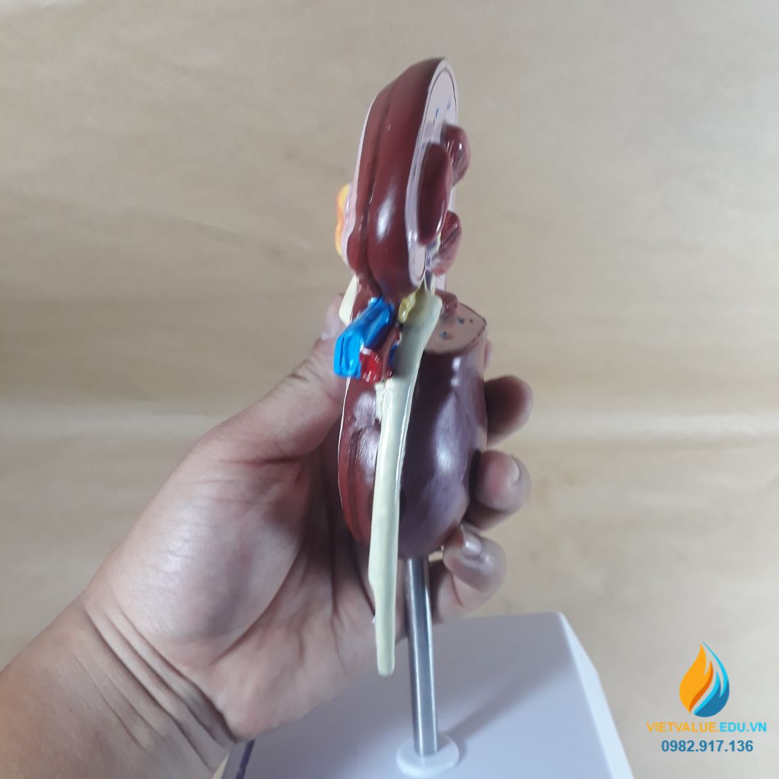 Mô hình quả thận, mô hình bệnh lý thận, mô hình giải phẫu giảng dạy