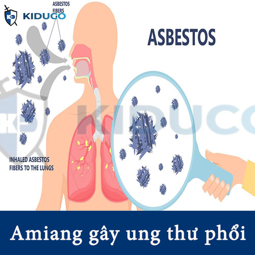 Nguy hại của vật liệu amiang