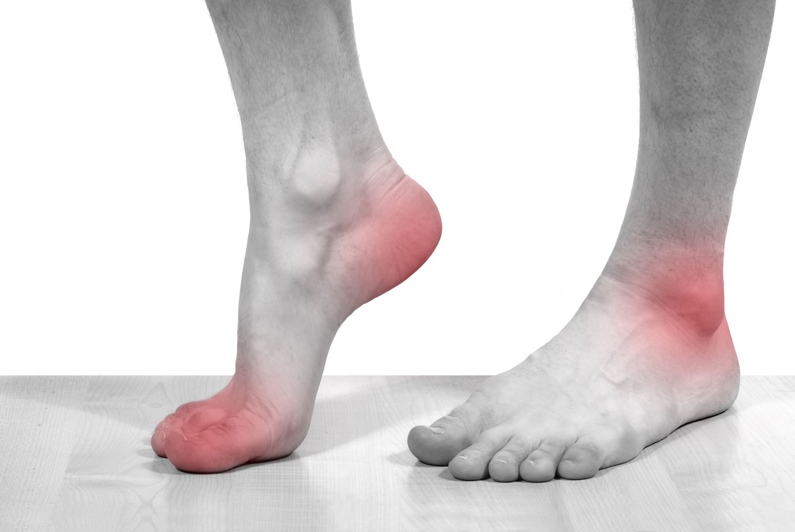 Nguyên nhân và triệu chứng của bệnh nhà Giàu- bệnh Gút