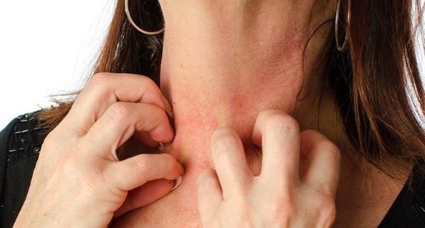 Việc đeo dây chuyền khi ngủ có thể làm trầy xước da