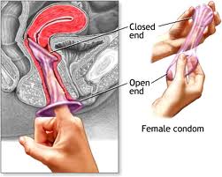 bao cao su nữ