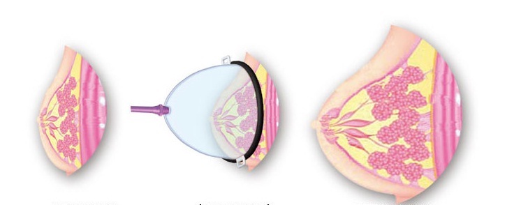 máy tập to ngực