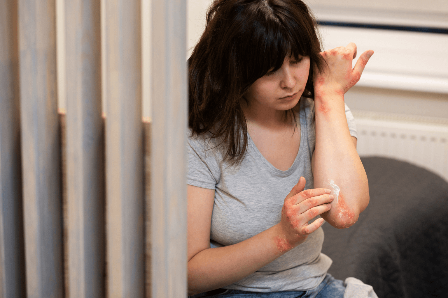 Các vết ban đỏ khi bị dị ứng bao cao su