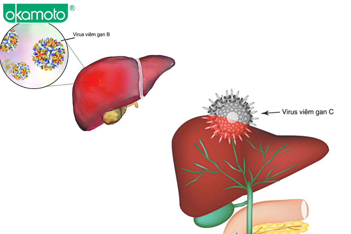 viem gan b c nguy co lay nhiem khi quan he dong gioi