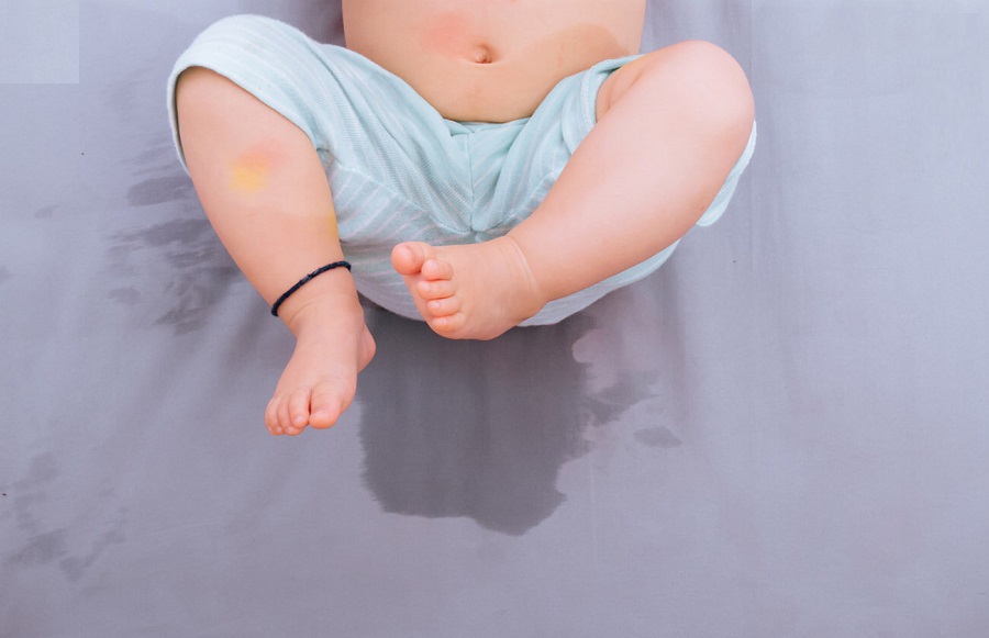 Những vết bẩn dạng lỏng tích tụ lâu ngày khiến đệm có mùi và bị ố vàng theo thời gian