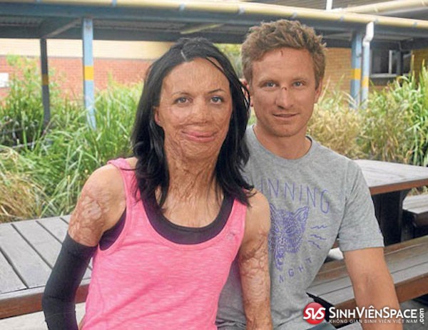 Chuyện tình đẹp nhất Australia3