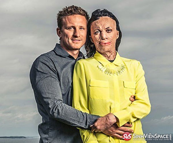 Chuyện tình đẹp nhất Australia4