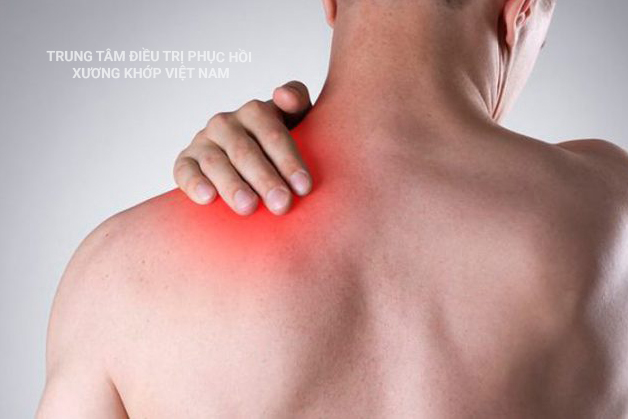 Bả vai nhức mỏi