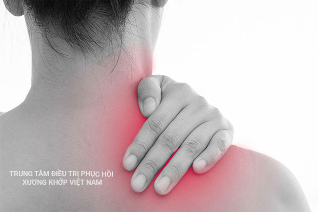 Bả vai nhức mỏi