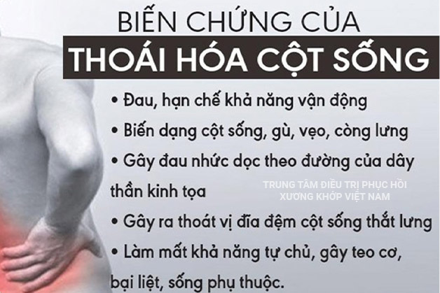 Biến chứng nguy hiểm của Thoái hóa cột sống