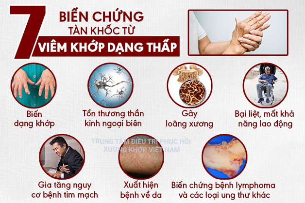 Biến chứng tàn khốc bệnh Viêm đa khớp dạng thấp 