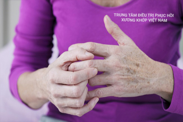 Các cơn Đau khớp bàn tay, bàn chân, khớp vai khiến bà vô cùng khó chịu