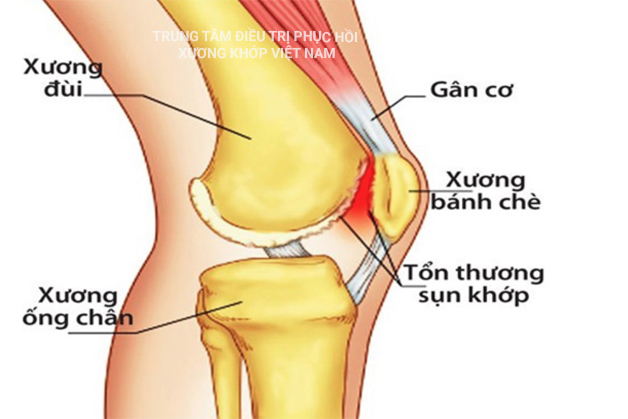 Cấu tạo cơ xương khớp gối