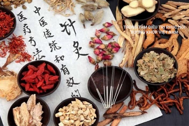 Chữa Bệnh đau thần kinh tọa bằng Đông Y