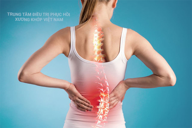 Đau lưng là triệu chứng phổ biến 
