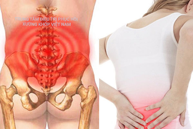 Đau vùng xương cụt