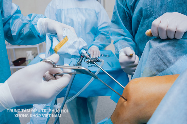 Điều trị ngoại khoa thoái hóa khớp