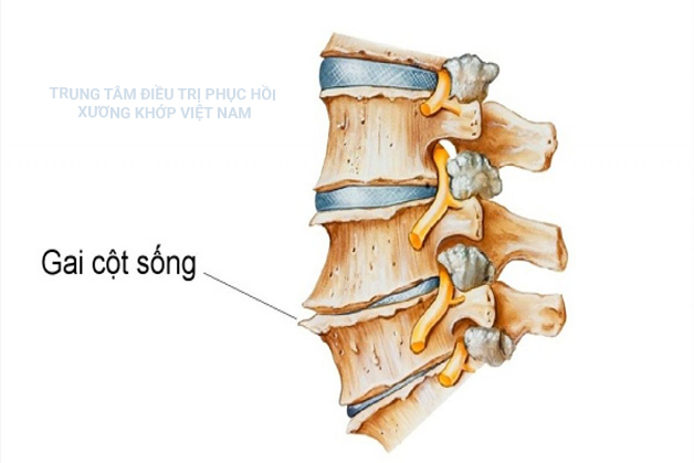 Gai cột sống