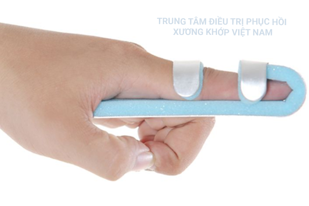 Hạn chế vận động gân bị tổn thương