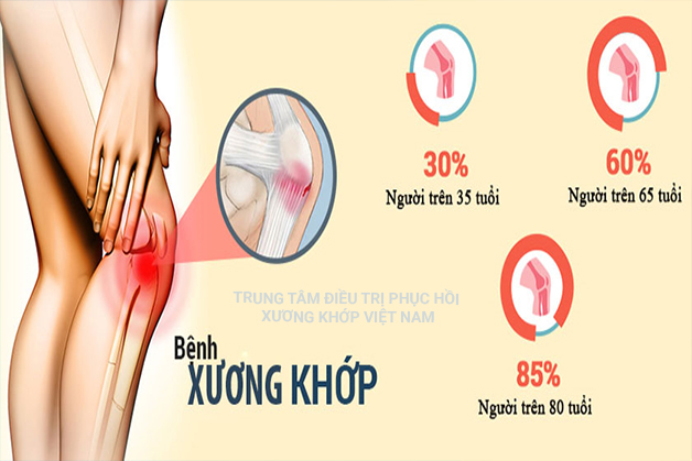 Hành trình vượt qua các cơn đau do bệnh xương khớp gây ra