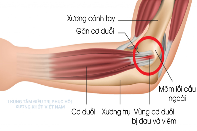 Mức độ kích thích dây thần kinh lớn 