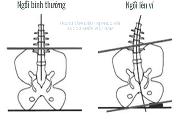 Ngồi bình thường, ngồi lên ví