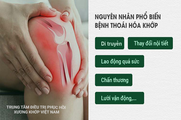 Nguyên nhân gây ra thoái hóa khớp