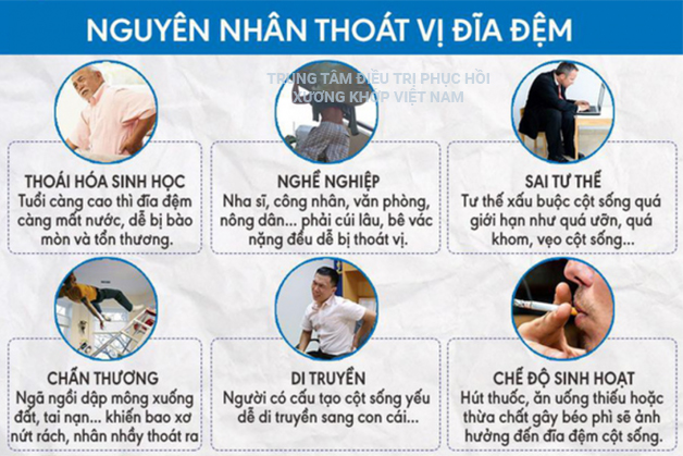 Nguyên nhân gây ra Thoát vị đĩa đệm