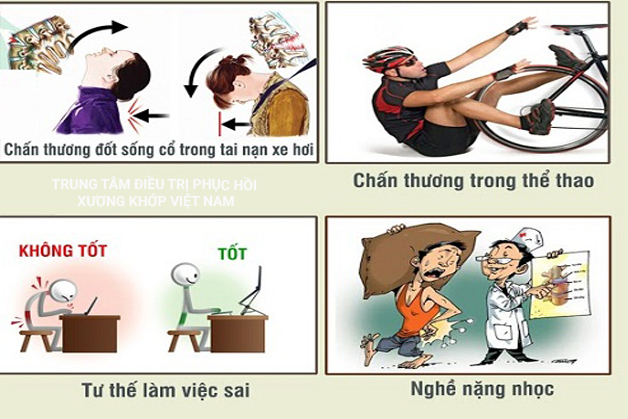 Nguyên nhân phổ biến dẫn đến Bệnh xương khớp