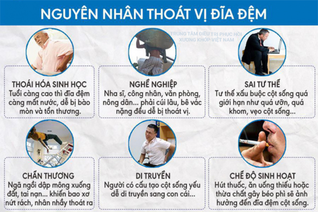 Nguyên nhân thoát vị đĩa đệm