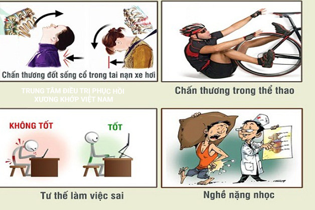 Những nguyên nhân phổ biến dẫn đến bệnh xương khớp