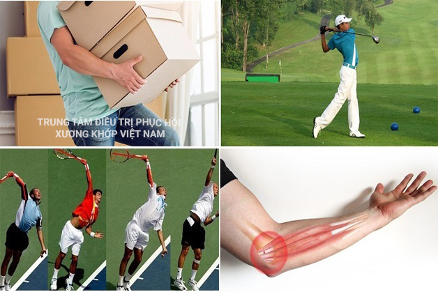 Tennis elbow - Hội chứng đau khủy tay tennis