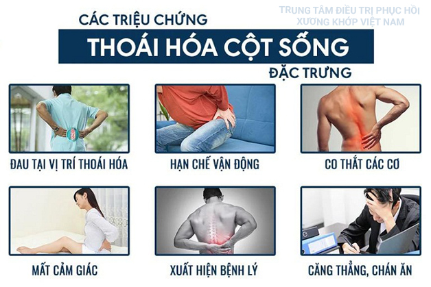 Biến chứng của người bị bệnh gai cột sống gây đau nhức khó chịu