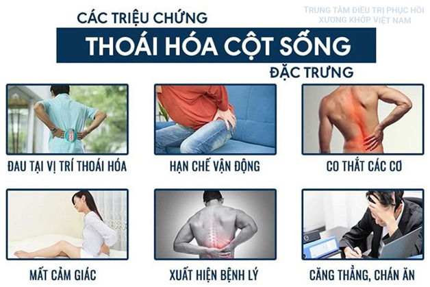 Triệu chứng Thoái hóa cột sống