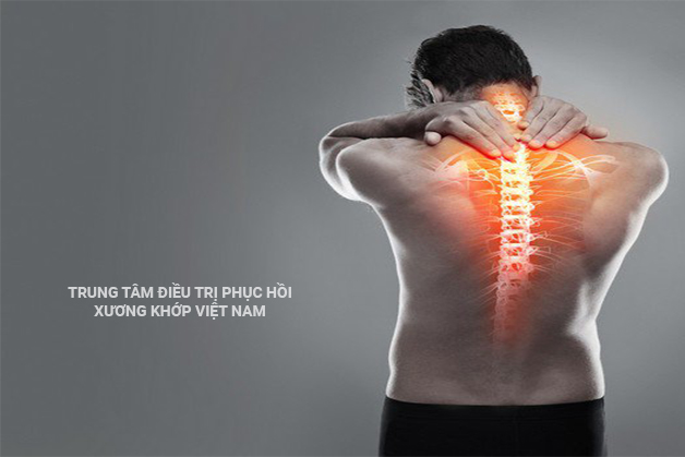 Vôi hóa cột sống