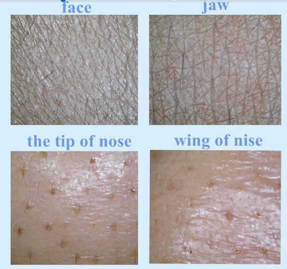 Máy soi da vi tính B-326C