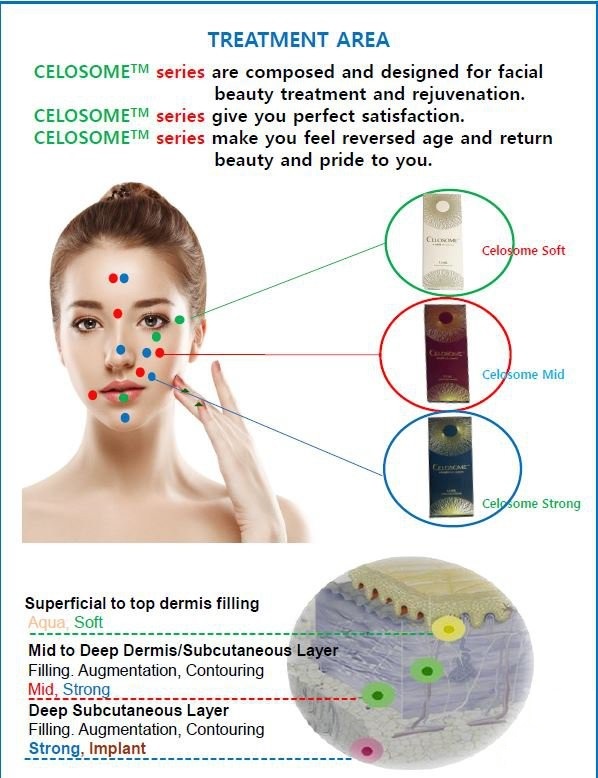 Chất làm đầy da Fillter Celosome