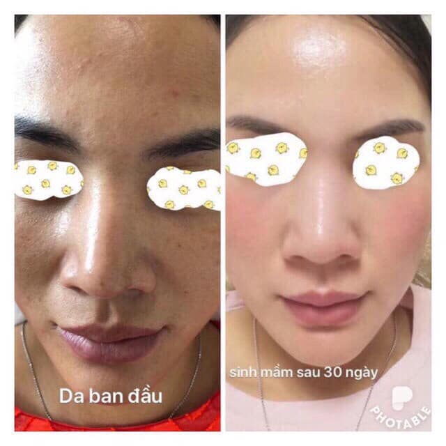 Công nghệ tái sinh mầm tế bào