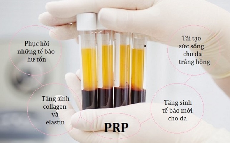 Làm đẹp với phương pháp PRP