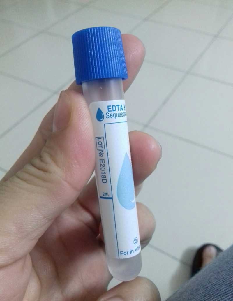 ống đựng máu xét nghiệm EDTA