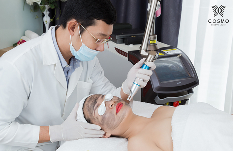 Quy trình thực hiện laser carbon peel