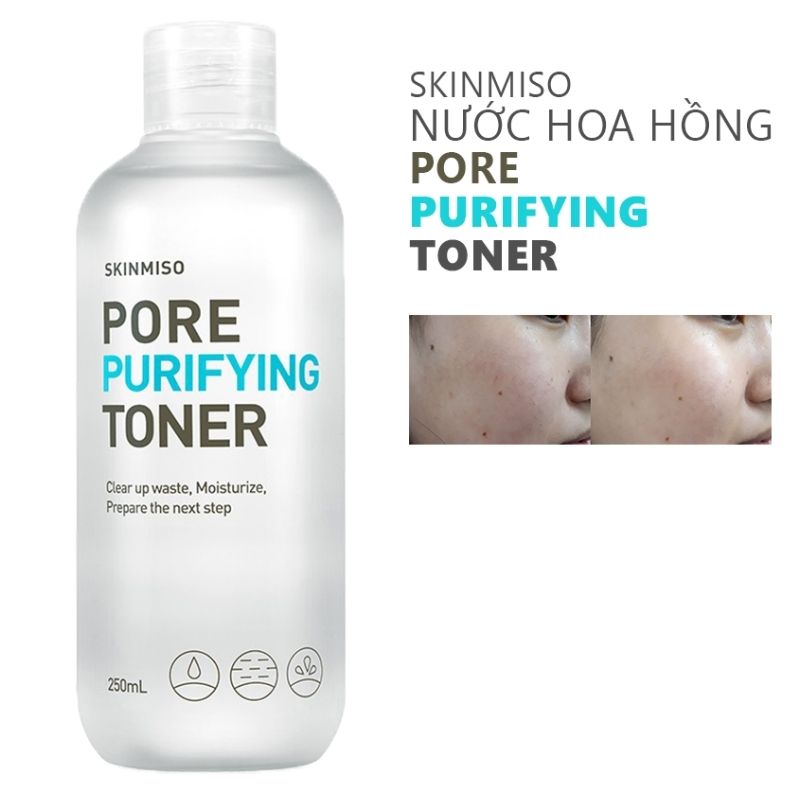 nuoc hoa hong skinmiso pore purifying toner 1