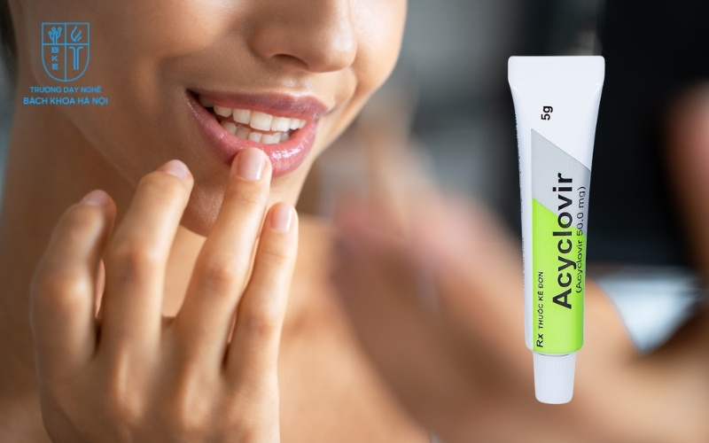 Tuyệt đối không dùng Acyclovir như thuốc bôi dưỡng môi sau phun