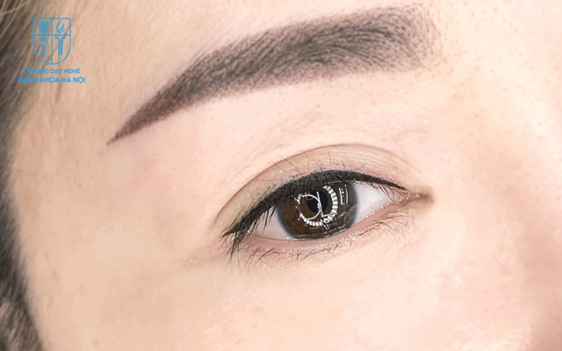 Dù có nhiều biến tấu khác nhau, điểm chung của các phương pháp này là làm đẹp mà không cần can thiệp sâu như phẫu thuật