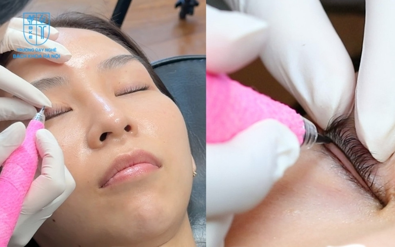 Thực hiện đúng những lưu ý này sẽ giúp bạn an tâm hơn khi đưa ra quyết định có nên phun mí mắt không